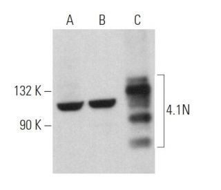 4.1N Antibody (F-2) - Western Blotting - Image 366915Each CRISPR/Cas9 Knockout (KO) Plasmid product consists of a pool of 3 plasmids designed to ensure identification and cleavage of a specific gene for maximum knockout efficiency. Each plasmid encodes a unique 20 nt sequence derived from the GeCKO (v2) library.