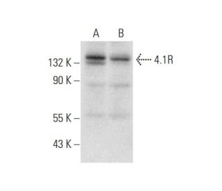 4.1R Antibody (B-11) - Western Blotting - Image 311985 