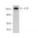 4.1R Antibody (D-11) - Western Blotting - Image 380342