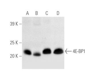 western blotting image from recommended 4E-BP1 (P-1) monoclonal antibody replacement. Image 3488