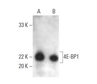 4E-BP1 Antibody (P-1) - Western Blotting - Image 394402 