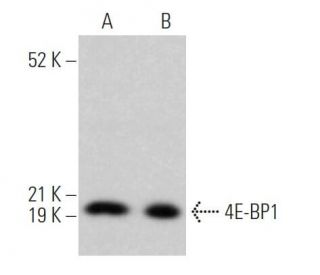 4E-BP1 Antibody (11G12C11) - Western Blotting - Image 370884