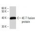 4E-T Antibody (2314C3a) - Western Blotting - Image 16925