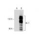 4E-T Antibody (2314C3a) - Western Blotting - Image 282088 