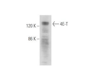 western blotting image from recommended 4E-T (B-3) monoclonal antibody replacement. Image 344627