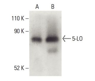 5-LO Antibody (A-9) - Western Blotting - Image 399514 