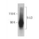 5-LO Antibody (A-9) - Western Blotting - Image 399512