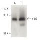 5-LO Antibody (A-9) - Western Blotting - Image 399514 
