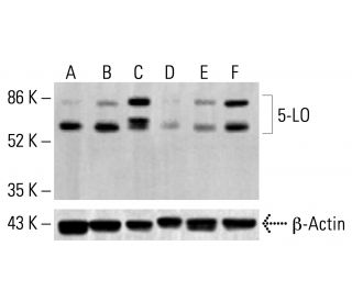 5-LO Antibody (33) - Western Blotting - Image 412877 