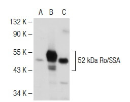 52 kDa Ro/SSA Antibody (D-12) | SCBT - Santa Cruz Biotechnology