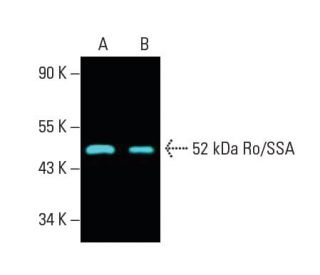 52 kDa Ro/SSA Antibody (D-12) - Western Blotting - Image 396201