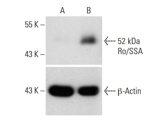 52 kDa Ro/SSA Antibody (E-11) | SCBT - Santa Cruz Biotechnology
