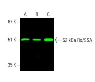 western blotting image from recommended 52 kDa Ro/SSA (D-12) monoclonal antibody replacement. Image 377852