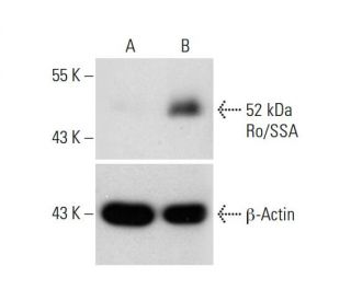 52 kDa Ro/SSA CRISPR Activation Plasmid (h): sc-400885-ACT. Western blot analysis of 52 kDa Ro/SSA expression in non-transEach CRISPR/Cas9 Knockout (KO) Plasmid product consists of a pool of 3 plasmids designed to ensure identification and cleavage of a specific gene for maximum knockout efficiency. Each plasmid encodes a unique 20 nt sequence derived from the GeCKO (v2) library.