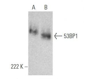 western blotting image from recommended 53BP1 (E-10) monoclonal antibody replacement. Image 368579