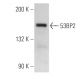 53BP2 Antibody (DX54.10) - Western Blotting - Image 14602 