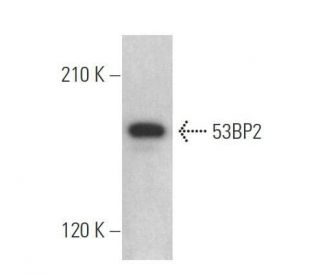 53BP2 Antibody (DX54.10) - Western Blotting - Image 358893 