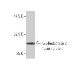 5&alpha;-Reductase 2 Antibody (1F4) - Western Blotting - Image 348854