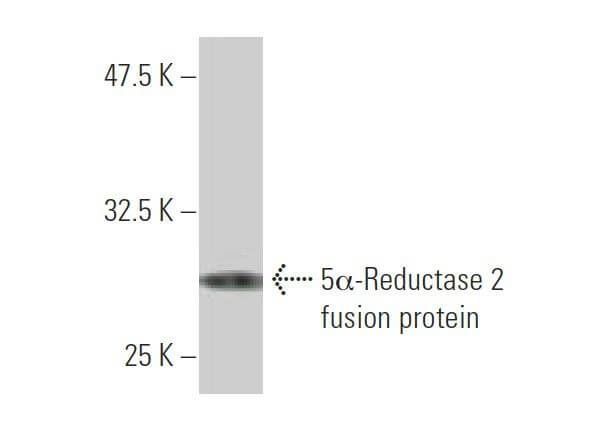 5α-Reductase 2 Antibody (1F4) | SCBT - Santa Cruz Biotechnology