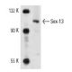Sox-13 (H-300): sc-20097. Western blot analysis of Sox-13 expression in A-10 nuclear extract.