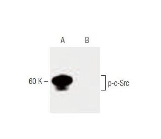 A-431 + AP Cell Lysate: sc-24651. Western blot analysis of...