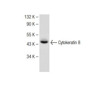 Cytokeratin 8 Antibody (A-9) - Western Blotting - Image 149634