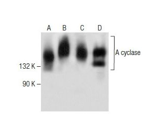 western blotting image from recommended Adenylate cyclase/ADCY (C-5) monoclonal antibody replacement. Image 282569