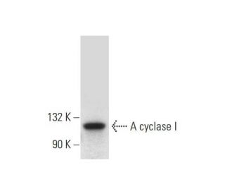 western blotting image from recommended Adenylate cyclase 1/AC1/ADCY1 (F-10) monoclonal antibody replacement. Image 139433