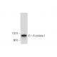 western blotting image from recommended Adenylate cyclase 1/AC1/ADCY1 (F-10) monoclonal antibody replacement. Image 139433