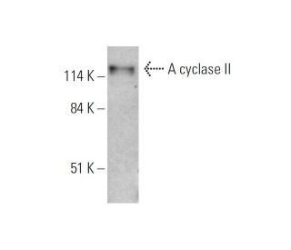 western blotting image from recommended Adenylate cyclase 2/AC2/ADCY2 (F-7) monoclonal antibody replacement. Image 333446