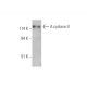 western blotting image from recommended Adenylate cyclase 2/AC2/ADCY2 (F-7) monoclonal antibody replacement. Image 333446