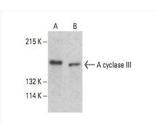 Adenylate cyclase 3/AC3/ADCY3 Antibody (C-5) - Western Blotting - Image 392596 
