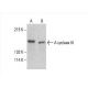 Adenylate cyclase 3/AC3/ADCY3 Antibody (C-5) - Western Blotting - Image 392596 