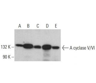 western blotting image from recommended Adenylate cyclase 5/6/ADCY5/ADCY6 (B-6) monoclonal antibody replacement. Image 381426