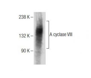 A cyclase VIII Antibody (B-4) - Western Blotting - Image 284508