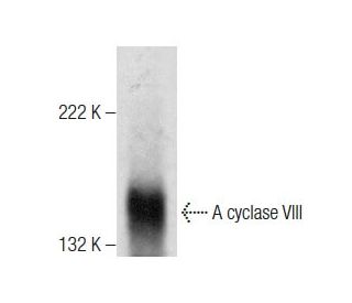 western blotting image from recommended Adenylate cyclase 8/AC8/ADCY8 (B-6) monoclonal antibody replacement. Image 283477