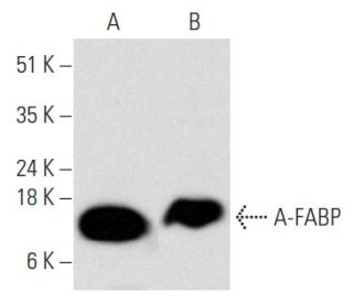 A-FABP Antibody (B-4) - Western Blotting - Image 354312