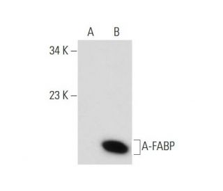 A-FABP (B-4): sc-271529. Western blot analysis of A-FABP expression in... 