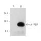 A-FABP (B-4) HRP: sc-271529 HRP. Direct western blot analysis...