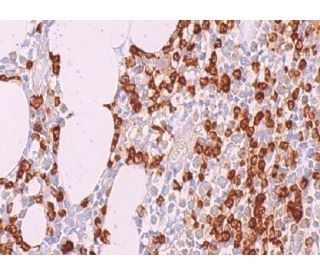 immunohistochemistry image from recommended A1 (B-3) monoclonal antibody replacement. Image 375186
