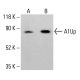 A1Up Antibody (M398) - Western Blotting - Image 413440