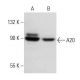 A20/TNFAIP3 Antibody (59A426) - Western Blotting - Image 15024