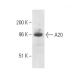 A20/TNFAIP3 Antibody (8E8.38) - Western Blotting - Image 10671
