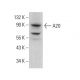 A20/TNFAIP3 Antibody (B-5) - Western Blotting - Image 376950