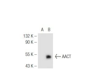 AACT Antibody (804) - Western Blotting - Image 49494 