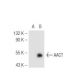 AACT Antibody (804) - Western Blotting - Image 49494 