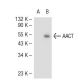 AACT Antibody (804) - Western Blotting - Image 51190