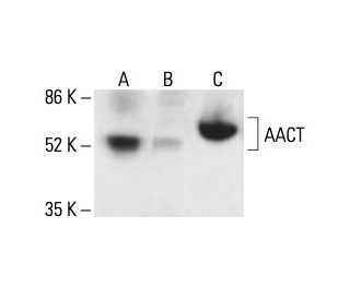AACT Antibody (F-10) - Western Blotting - Image 411255
