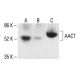 AACT Antibody (F-10) - Western Blotting - Image 411255