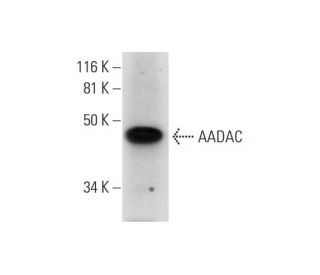 AADAC Antibody (G-12) - Western Blotting - Image 289592 
